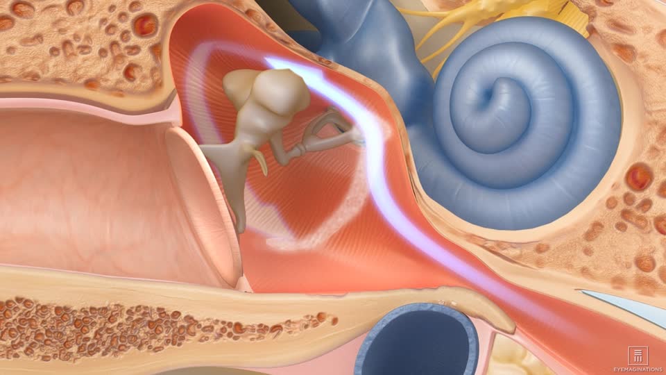 Eustachian Tube Dysfunction