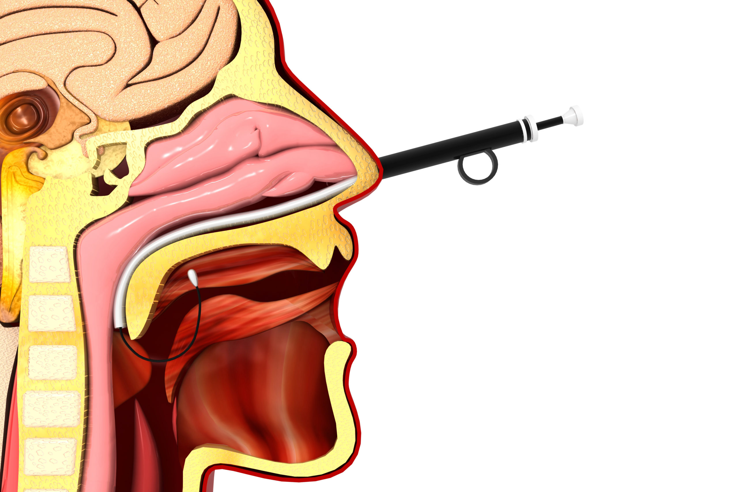 Balloon Sinus Dilation Equipment